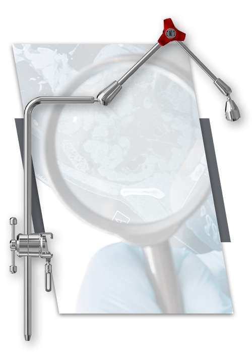 Sterilizable Surgical Articulated Arm for Colorectal Surgery